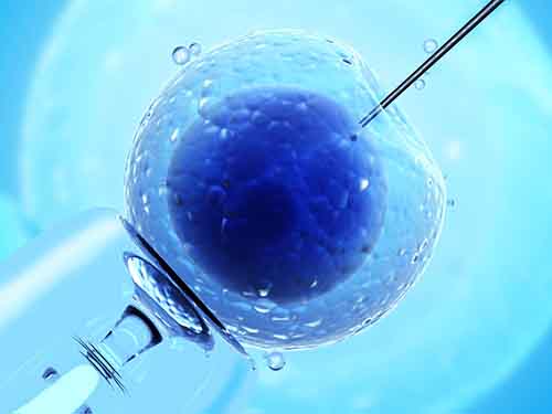 卵胞浆内单精子注射