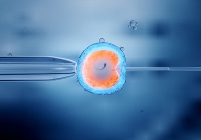 试管，人工受精和冷冻胚胎移植的费用