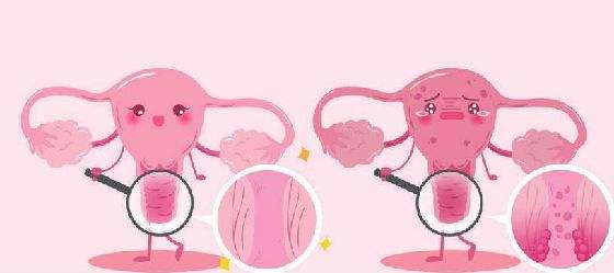 子宫内膜薄可以选择试管婴儿助孕吗？
