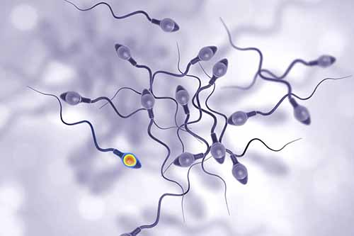 精子DNA碎片化