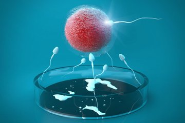 卵浆内单精子注射