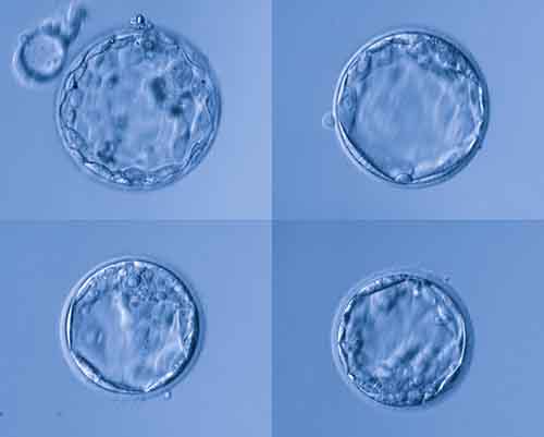 新鲜胚胎