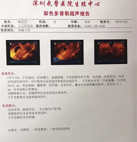 报告单