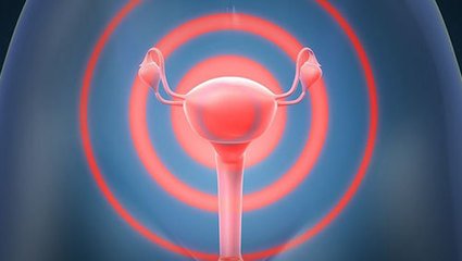 多囊卵巢综合征的治疗方法有哪些？