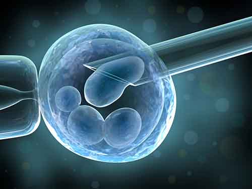 多囊卵巢综合征患者为什么不孕症的发生率高？