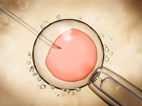 如何看待宫腔积液对胚胎种植的影响？