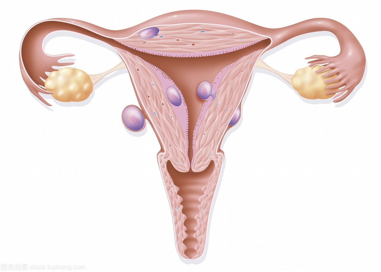 女性有子宫肌瘤还能怀孕吗