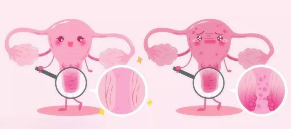 卵巢早衰是如何引起的？能顺利做试管婴儿吗？