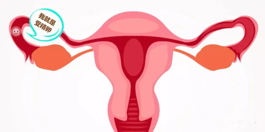 由输卵管因素引起的女性不孕是否可以进行试管婴儿？