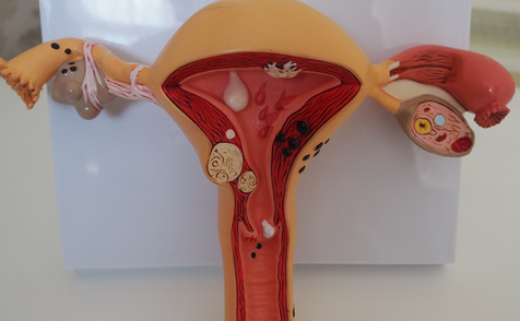 多囊卵巢综合症可以做试管吗？