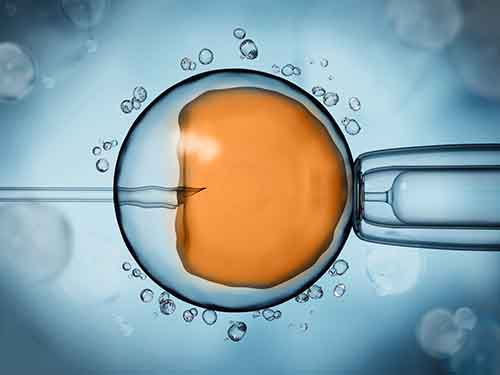 胚胎移植之后的注意事项是什么？