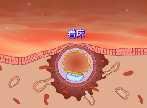 冻胚移植应该选择哪种子宫内膜准备方案？