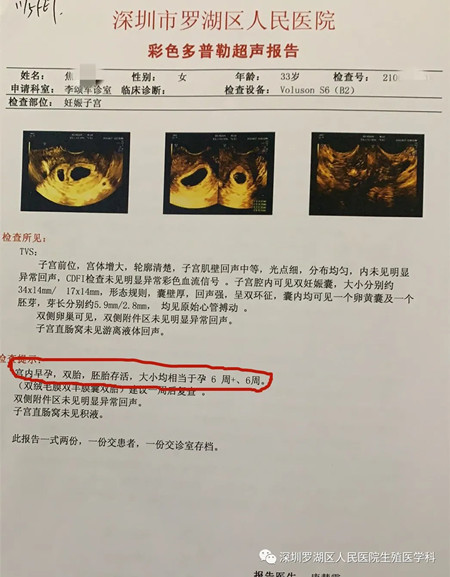 B超