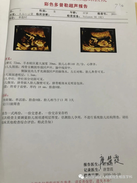 B超单